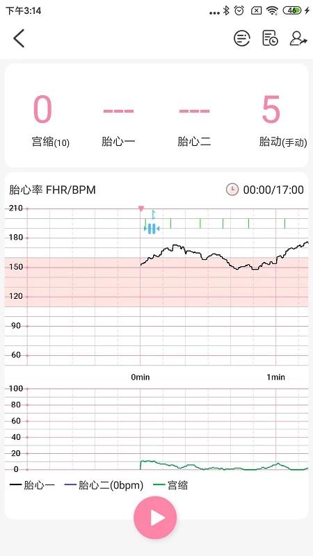 ������ҽ��1.8.18 ̥���ж������н�ͼ