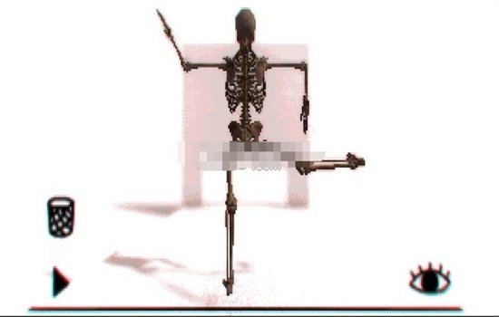 Osteotic Bypass��Ϸ���԰����ؽ�ͼ3