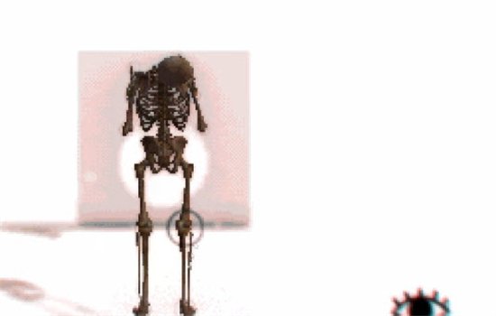 Osteotic Bypass��Ϸ���԰����ؽ�ͼ2