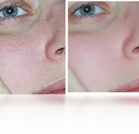 CleanSkinFX2026 Ƥ���Ż��������н�ͼ
