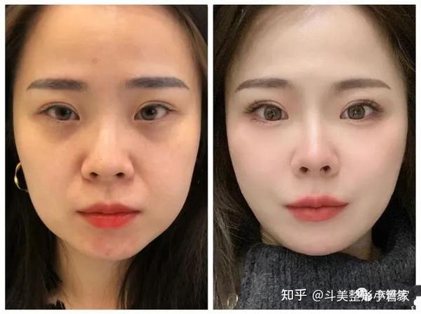 incrediface 人脸修复 前后对比 效果